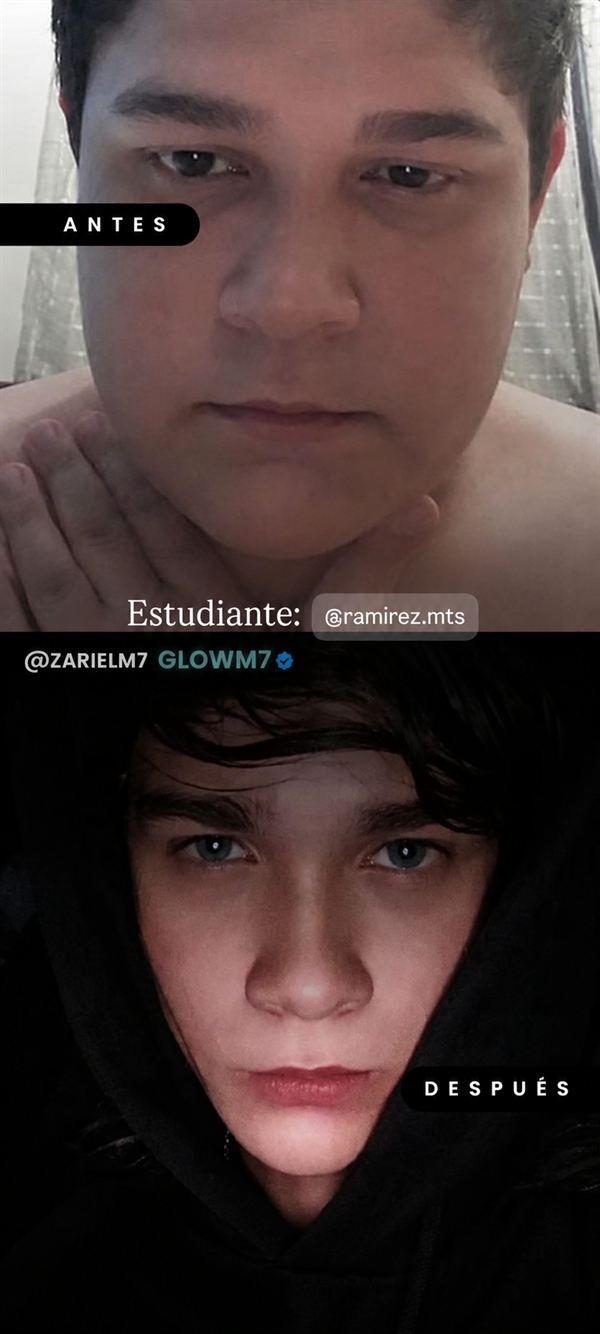 Antes y Después Alumno GLOWM7
